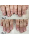 最強のネイルケア8回コース