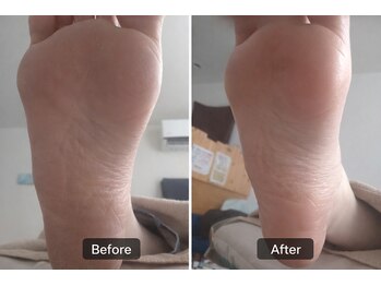 リラックス空間 しずく/角質ケア