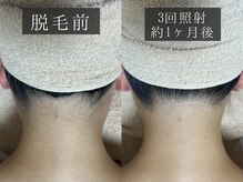 ベルフィーヌ 恵比寿店(BELFINE)/jerryの脱毛が選ばれる理由