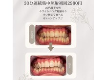 プラスビーセルフ(+b self)/ビフォーアフター