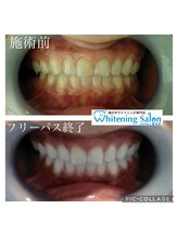 シフォン 豊田店/3週間通い放題フリーパス