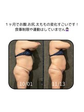 エクラ(ECLAT)/コアヒート痩身