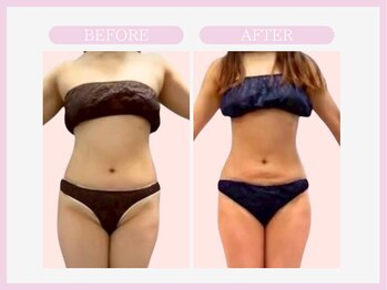 アコガレコガオ 青森店/