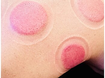 ファイン(fine)/カッピングコース