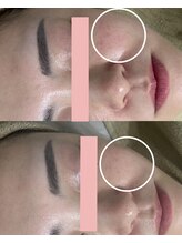 ビビィ(Bibiy)/クリスティーナ/アンストレス