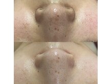 シェリー(Cherie)の雰囲気（スキンケアWAX脱毛で一度で綺麗な仕上がりに！）