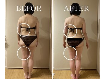 ヨサパーク サナ 二子玉川(YOSA PARK SANA)/痩身/ダイエット/よもぎ蒸し痩身