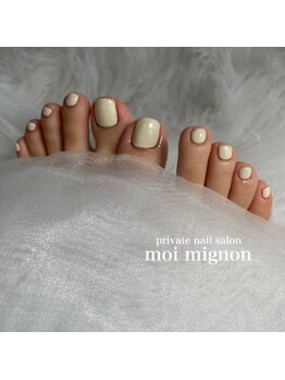 モワミニョン(moi mignon)の写真/【フットネイル×角質ケア】シンプルも普段できない派手目もお任せ♪個人の爪に合わせたデザイン◎