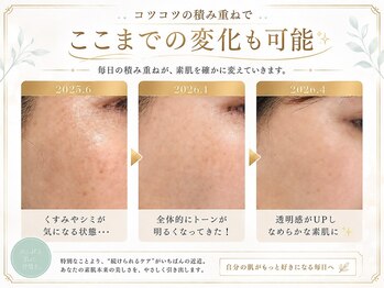 エフリア 大垣(F.lia)/ホームケアでここまで変わる！