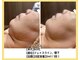リファイン(REFINE)の写真