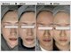エミエル(EMIER)の写真