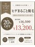 ヒゲまるごと脱毛【お得な回数券3回分】首のヒゲまでなくしたい方！