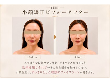 グローギンザ 銀座(GLOW GINZA)の写真