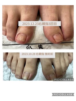 ブロックファイブハナ(Block 5 HANA)/