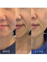 シーズボーテ(C's Beaute)/継続するほど変化します♪