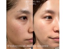 ルミヌーズ(Lumineuse)/美に特化した若よもぎ蒸し◎