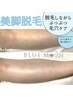 【夏キャンペーン1000円OFF】両足脱毛＋引き締め美容液付き¥8800→￥7800