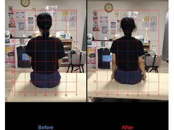 ストレチックス 近江八幡店/ストレッチ ビフォーアフター