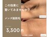 【メンズ脱毛】清潔感 UP!ワキ・手指脱毛 30分4400円