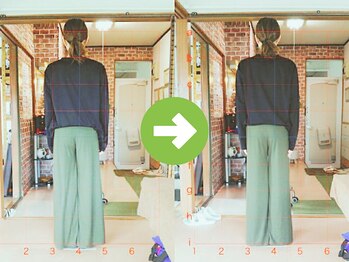 サプライズ整体院/20代ママの初回産後の骨盤矯正