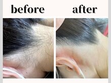 サロン ルーシュ(salon ruche)の雰囲気（肌が綺麗になる、結果重視の痛みの少ない脱毛）