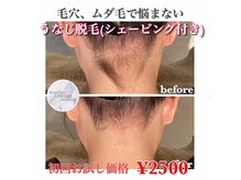 リノア 心斎橋店(LINOAH)/うなじ脱毛（シェービング付）