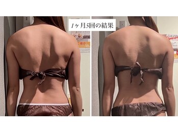 リラル 茅ヶ崎店(RERAR)/1ヶ月での結果だし