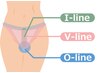 【女性女性】VIO脱毛/自己処理のチクチク卒業！匂い・黒ずみ対策に◎