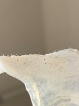 チアリー(Chiary)/鼻の黒ずみと思いきや！