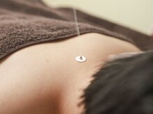 ロミアオ(Lomi-AO)/チクッと熱い透熱灸