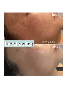 グラント ふじみ野店(grant)/