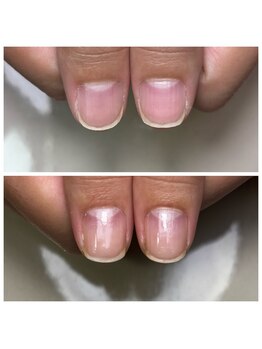 リヒネイル(Rihi.nail)/自爪育成