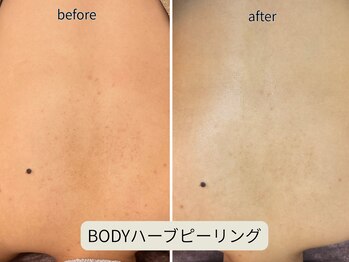 ヴェールココン(Veil Cocon)/