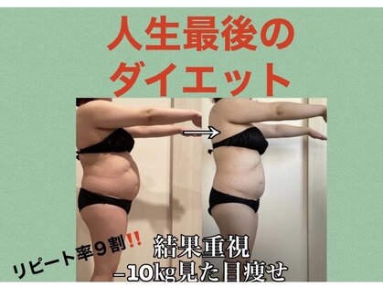 ヨサパーク タルタルーガ(YOSA PARK Tartaruga)の写真