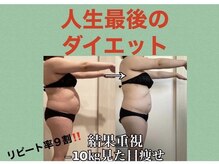 ヨサパーク タルタルーガ(YOSA PARK Tartaruga)