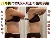 アンドバイ(&.BY)