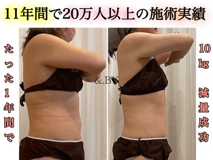 アンドバイ(&.BY)の写真