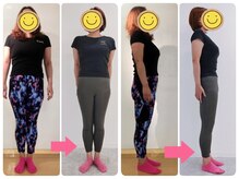 KWS股関節ウォーキングスタジオ/【6】股関節痛改善(40代・OL)