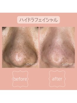 ビューティブロス(Beauty Bros)/