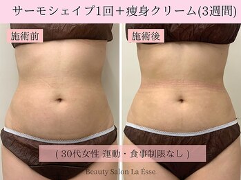 ラエッセ(La Esse)/くびれ創り得意です!