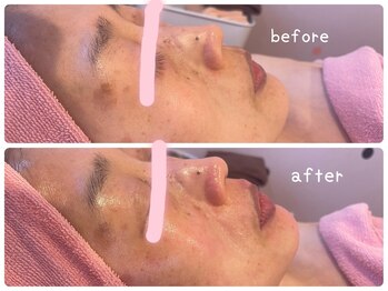 ヒメミ(Himemi)/艶肌Wax