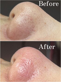 ティーツリー 名古屋 桜山(Tea Tree)/毎日ひたすら、、、