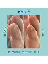 ピーアンドオー(P&O)/