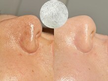 ルーナジェーナ(Luna llena)/池袋　エステ　ルーナジェーナ