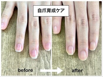 コバコ(kobaco)/自爪育成ケア　半年間の成果比較
