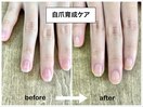 自爪育成ケア　半年間の成果比較