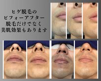 ボゴス 天白店(BOGOSS)