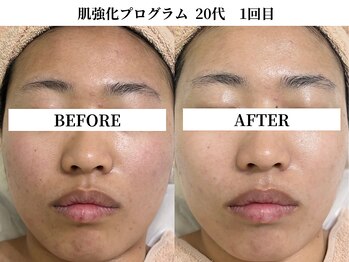 サンビ(SANBI)/汚れをOFFしてたっぷり保湿