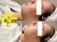 上野エステサロン レア(Lea)の写真