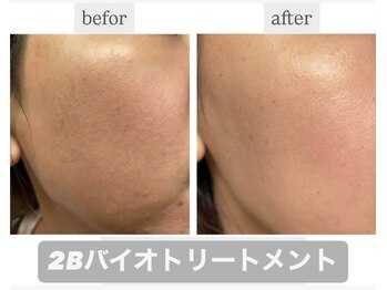 シャムリー 並木坂(Syamry)/結果を出すお肌悩み改善ハーブ